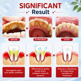 SP-4 Probiotic Brightening and cleaning toothpaste